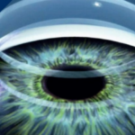 Cornea transplants 3d printing human cells eyes science
