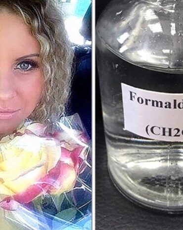 Embalmed alive russia formaldehyde how caleb wilde