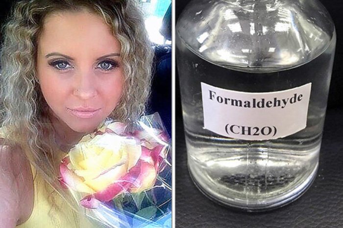 Russian woman embalmed alive in deadly hospital mistake Embalmed alive russia formaldehyde how caleb wilde