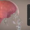 Elon musk brain implant startup neuralink monkeys euthanized