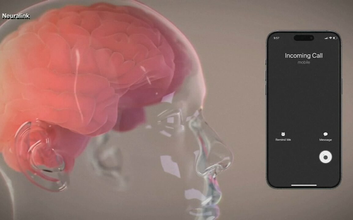 Elon musk brain implant startup neuralink monkeys euthanized