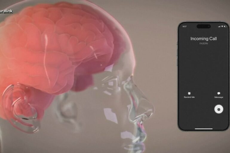Elon musk brain implant startup neuralink monkeys euthanized