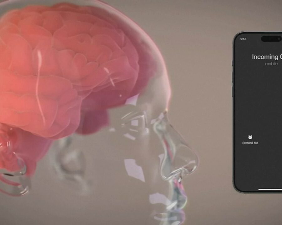 Elon musk brain implant startup neuralink monkeys euthanized
