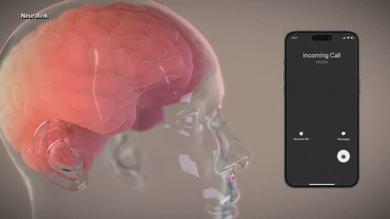 Elon musk brain implant startup neuralink monkeys euthanized
