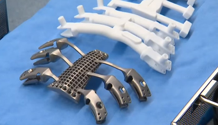 Sound waves could 3d print implants inside your body