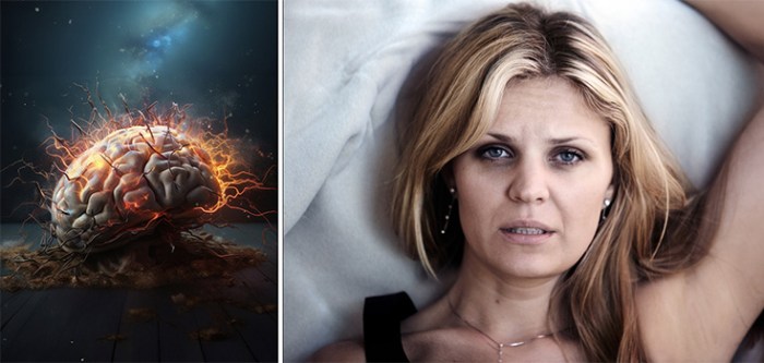 If you arent sleeping your brain might be aging prematurely