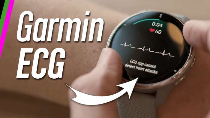 Garmin ecg app added to venu 3 and other watches