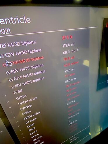 Imaging ai autonomous chest xray eu fda
