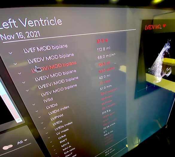 Imaging ai autonomous chest xray eu fda