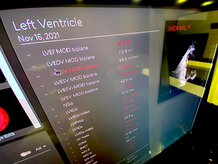 Imaging ai autonomous chest xray eu fda